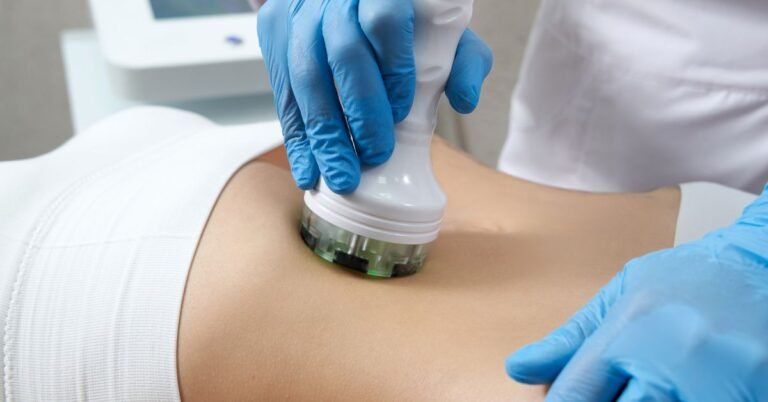 CoolSculpting Treatment